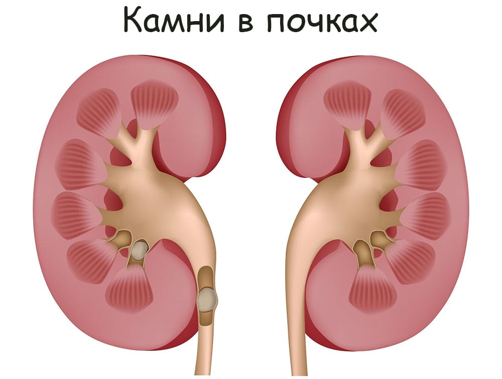 Гидра зайти кракен